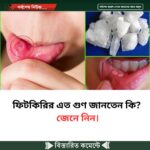 ফিটকিরির এত গুণ জানতেন কি? জেনে নিন।