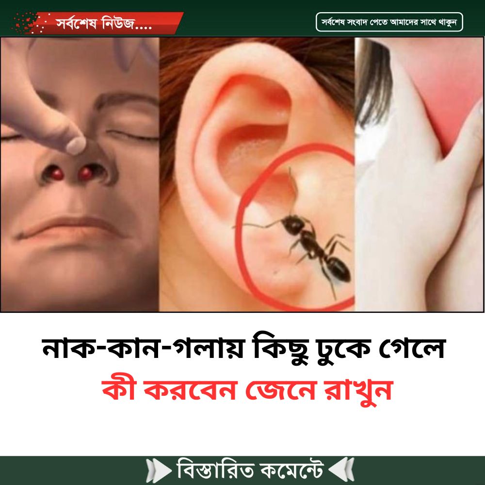 নাক-কান-গলায় কিছু ঢুকে গেলে কী করবেন জেনে রাখুন