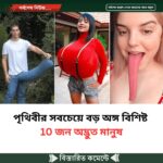 পৃথিবীর সবচেয়ে বড় অঙ্গ বিশিষ্ট 10 জন অদ্ভুত মানুষ