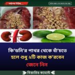 কি’ডনি’র পাথর থেকে বাঁ’চতে হলে শুধু ২টি কাজ ক’রবেন