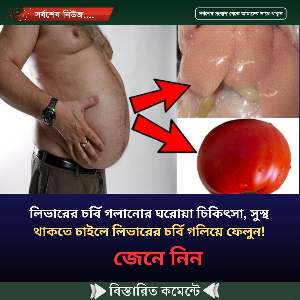 লিভারের চর্বি গলানোর ঘরোয়া চিকিৎসা, সুস্থ থাকতে চাইলে লিভারের চর্বি গলিয়ে ফেলুন!
