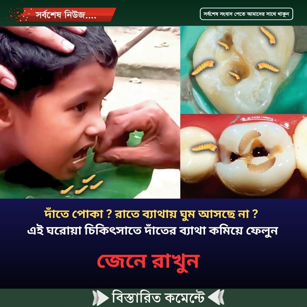 দাঁতে পোকা ? রাতে ব্যাথায় ঘুম আসছে না ? এই ঘরোয়া চিকিৎসাতে দাঁতের ব্যাথা কমিয়ে ফেলুন