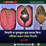 কিডনি বা ফুসফুস সুস্থ আছে কিনা পরীক্ষা করুন চামচ দিয়েই!