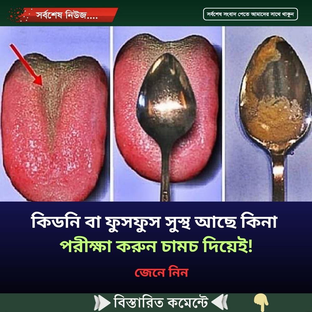 কিডনি বা ফুসফুস সুস্থ আছে কিনা পরীক্ষা করুন চামচ দিয়েই!
