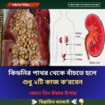 কি’ডনি’র পাথর থেকে বাঁ’চতে হলে শুধু ২টি কাজ ক’রবেন