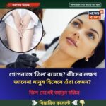 গোপনাঙ্গে ‘তিল’ রয়েছে? কীসের লক্ষণ জানেন! মানুষ হিসেবে এঁরা কেমন? তিল দেখেই জানুন চরিত্র