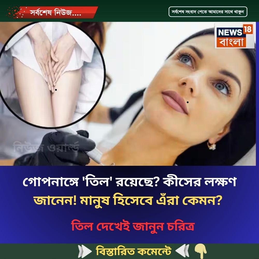 গোপনাঙ্গে ‘তিল’ রয়েছে? কীসের লক্ষণ জানেন! মানুষ হিসেবে এঁরা কেমন? তিল দেখেই জানুন চরিত্র