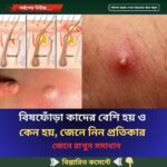 বিষফোঁড়া কাদের বেশি হয় ও  কেন হয়, জেনে নিন প্রতিকার