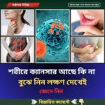 শরীরে ক্যানসার আছে কি না বুঝে নিন লক্ষণ দেখেই