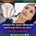 গোপনাঙ্গে ‘তিল’ রয়েছে? কীসের লক্ষণ জানেন! মানুষ হিসেবে এঁরা কেমন?