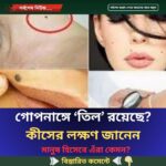 গোপনাঙ্গে ‘তিল’ রয়েছে? কীসের লক্ষণ জানেন