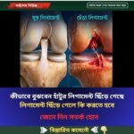 কীভাবে বুঝবেন হাঁটুর লিগামেন্ট ছিঁড়ে গেছে লিগামেন্ট ছিঁড়ে গেলে কি করতে হবে