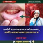 এগুলিই ক্যানসারের প্রথম পর্যায়ের লক্ষণ, মোটেই একবেলাও অবহেলা করবেন না