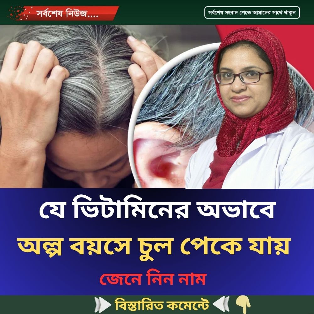 যে ভিটামিনের অভাবে অল্প বয়সে চুল পেকে যায়…see more